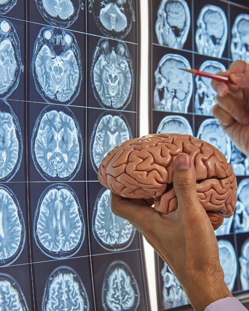 hospital de neurocirugía