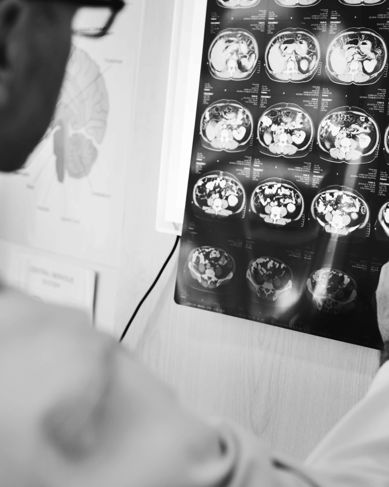 Médico Neurocirujano en CDMX