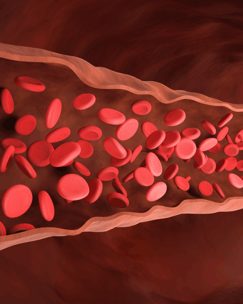 Neurocirujano para Malformación Arteriovenosa